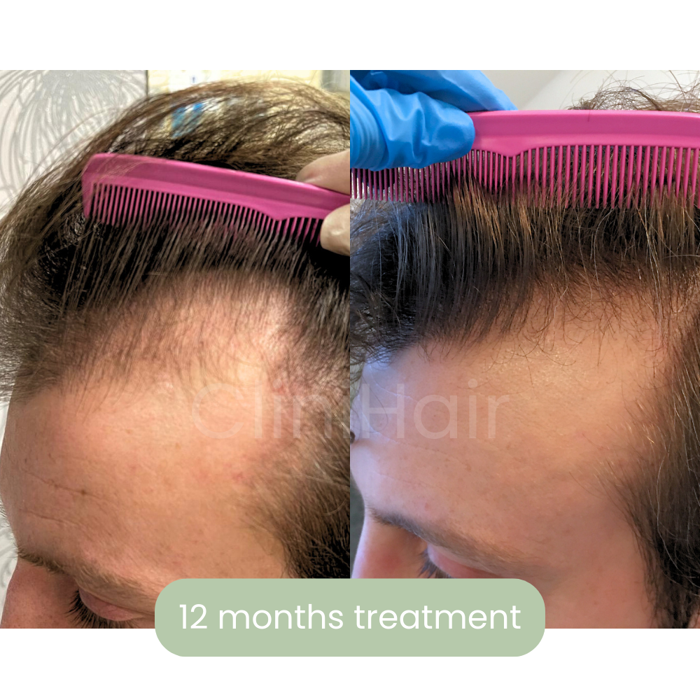 6 months treatment